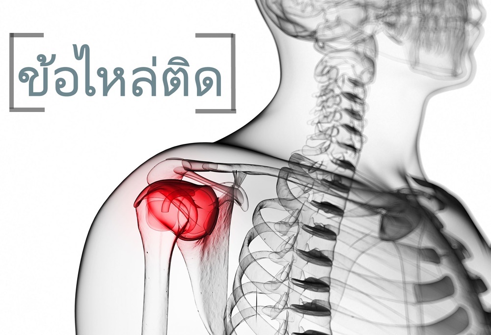 ข้อไหล่ติด thaihealth