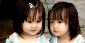 ฝาแฝดไม่ใช่เงาของกันและกัน พ่อแม่ต้องเลี้ยงดูด้วยความเข้าใจ  