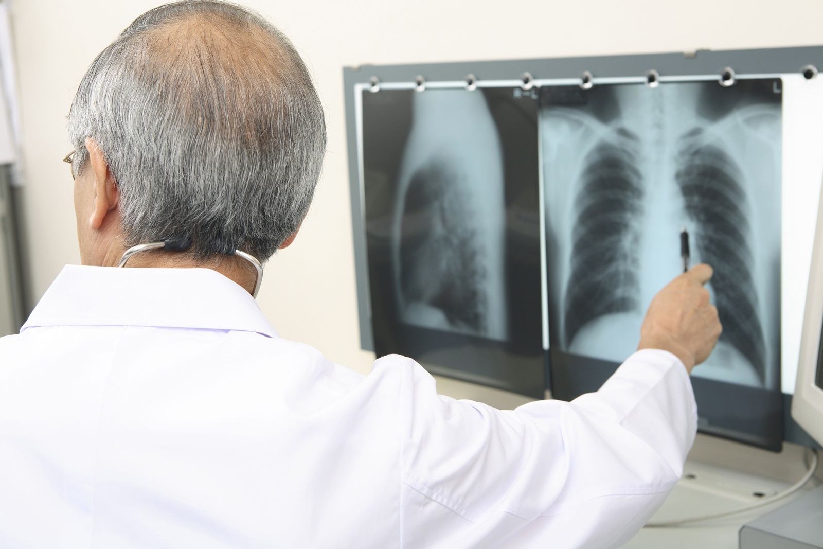รวมพลังยุติ“วัณโรค”รู้ทันป้องกันได้ thaihealth