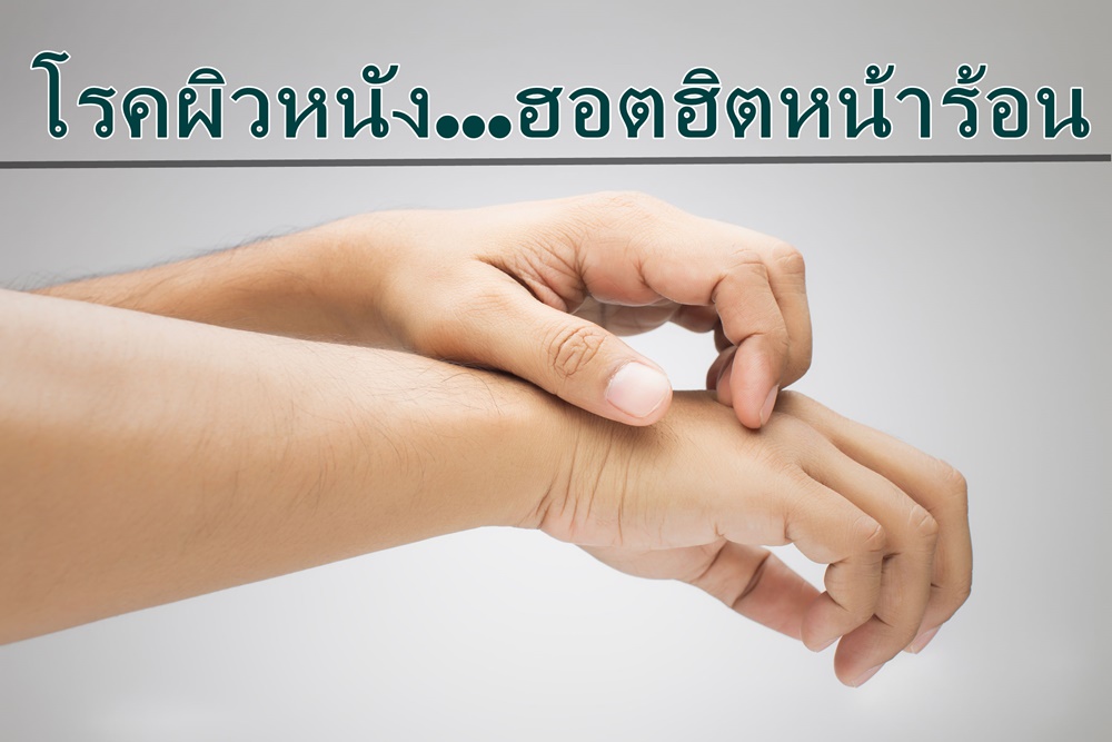 โรคผิวหนัง...ฮอตฮิตหน้าร้อน thaihealth