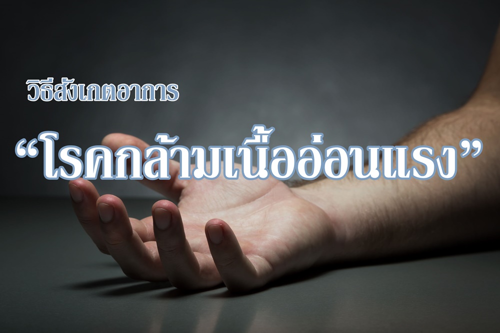 วิธีสังเกตอาการ “โรคกล้ามเนื้ออ่อนแรง”  thaihealth