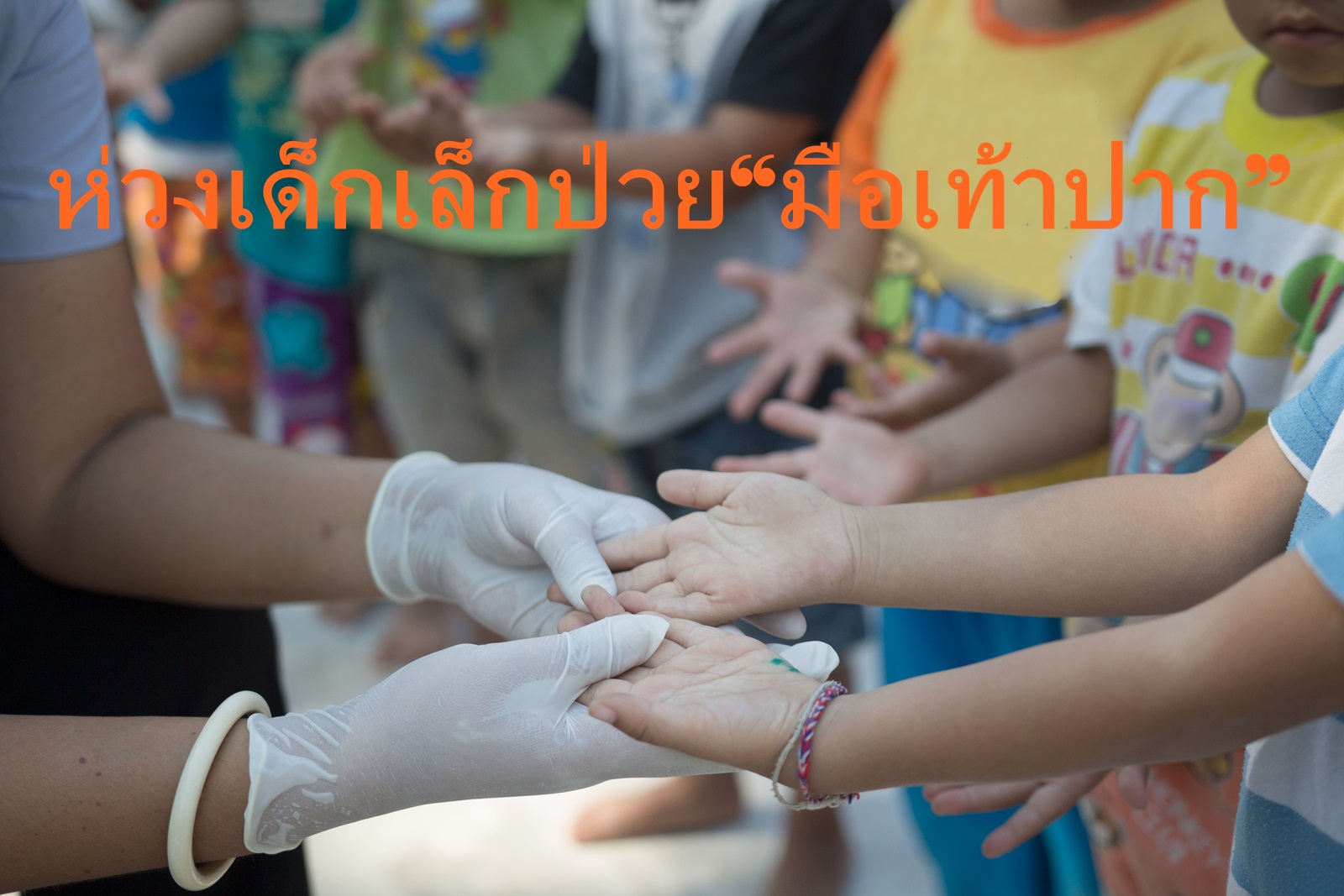 ห่วงเด็กเล็กป่วย“มือเท้าปาก” thaihealth