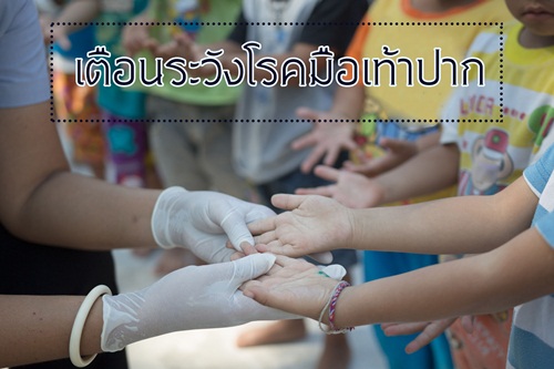 เตือนระวังโรคมือเท้าปาก thaihealth