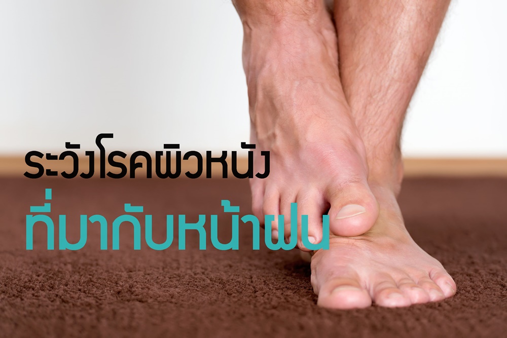 ระวังโรคผิวหนังที่มากับหน้าฝน thaihealth