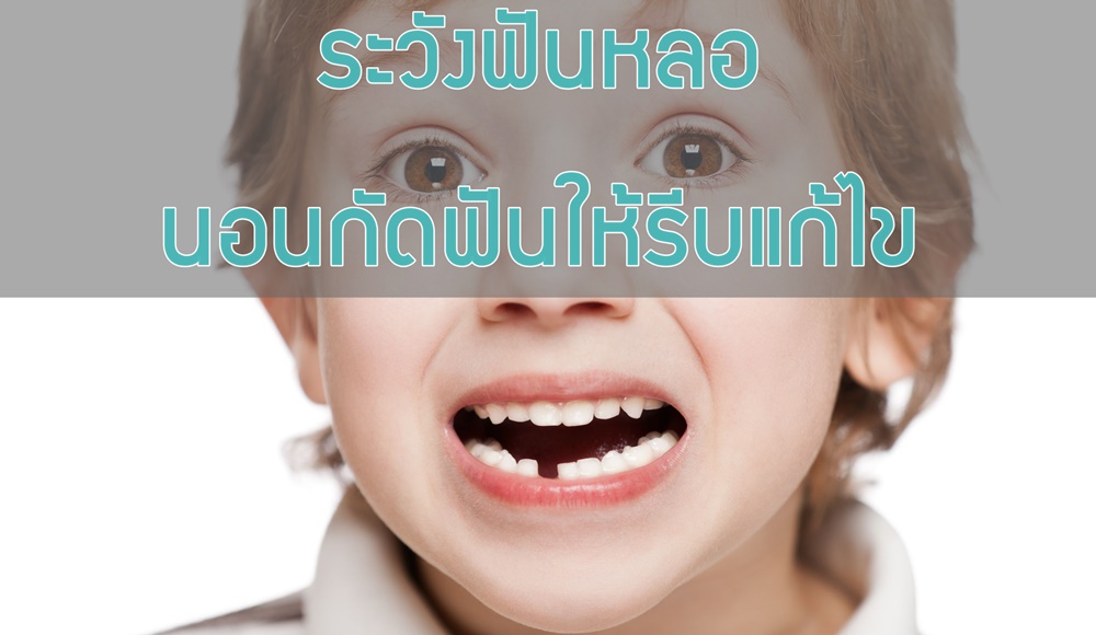 ระวังฟันหลอ นอนกัดฟันให้รีบแก้ไข thaihealth