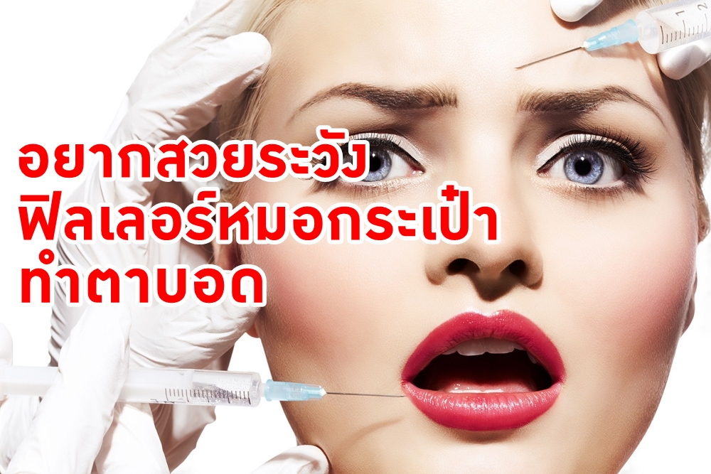 สวยระวัง 'ฟิลเลอร์หมอกระเป๋า' ทำตาบอด thaihealth