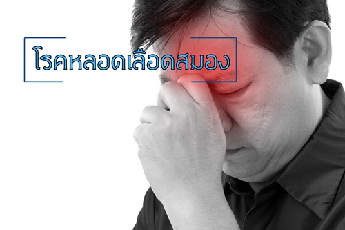 โรคหลอดเลือดสมอง   thaihealth