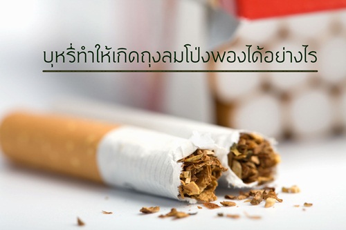 บุหรี่ทำให้เกิดถุงลมโป่งพองได้อย่างไร thaihealth