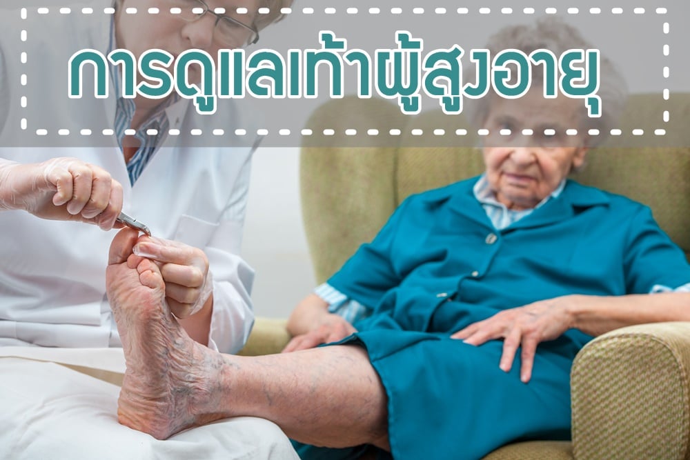 การดูแลเท้าผู้สูงอายุ thaihealth