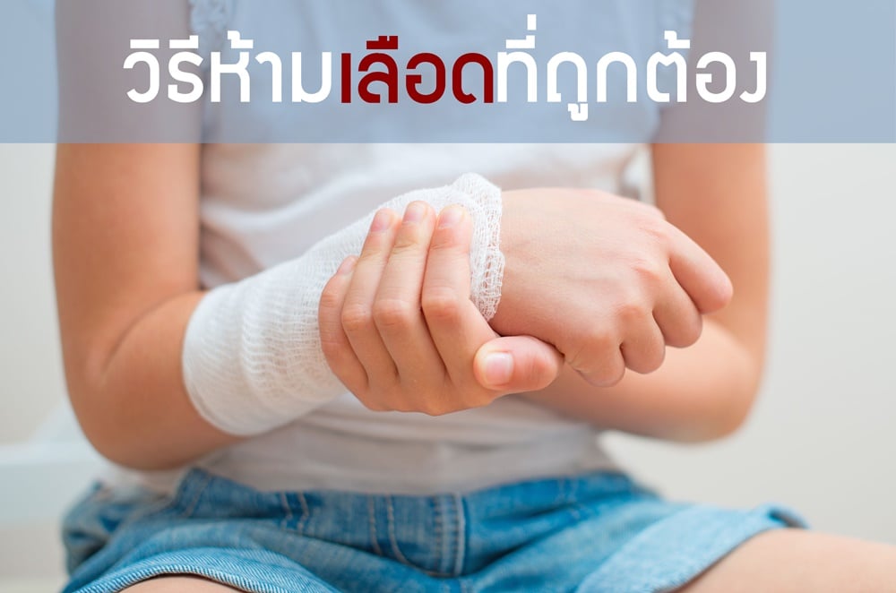 วิธีห้ามเลือดที่ถูกต้อง thaihealth