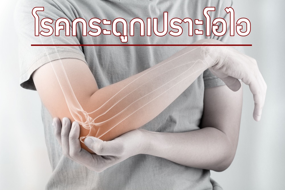 โรคกระดูกเปราะโอไอ thaihealth