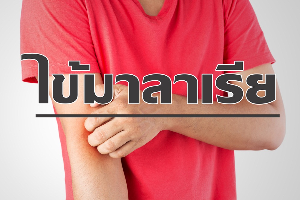 ไข้มาลาเรีย thaihealth