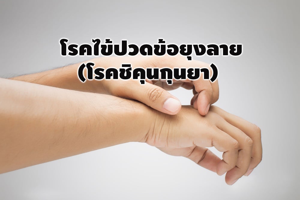 โรคไข้ปวดข้อยุงลาง (โรคชิคุนกุนยา)  thaihealth