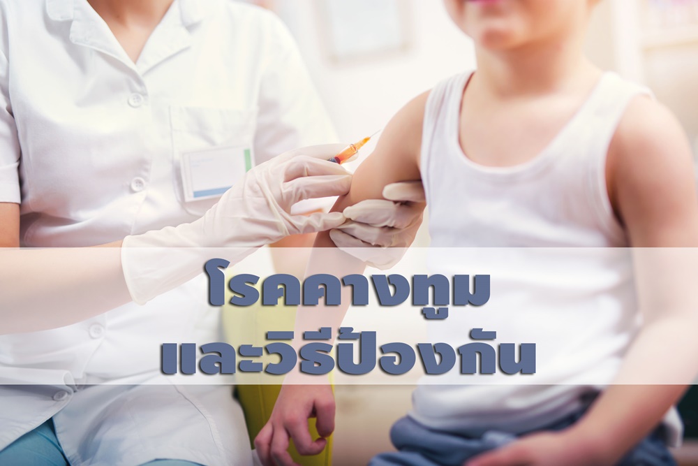โรคคางทูมและวิธีป้องกัน thaihealth