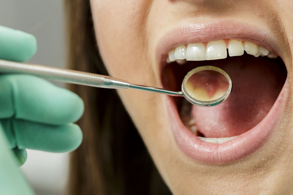 สภาทันตแพทย์ชี้ ‘จัดฟันแฟชั่น’ เริ่มลามเป็น ‘อุดฟันเถื่อน’ thaihealth