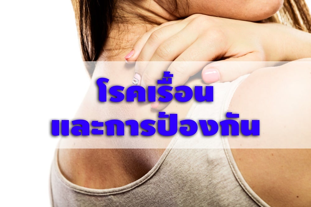 โรคเรื้อนและการป้องกัน thaihealth