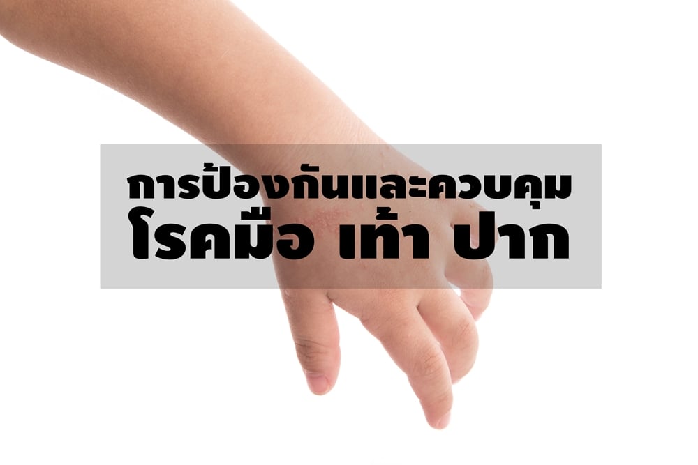 การป้องกันและควบคุม 