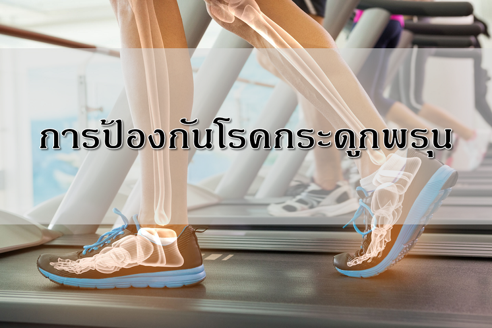 การป้องกันโรคกระดูกพรุน thaihealth