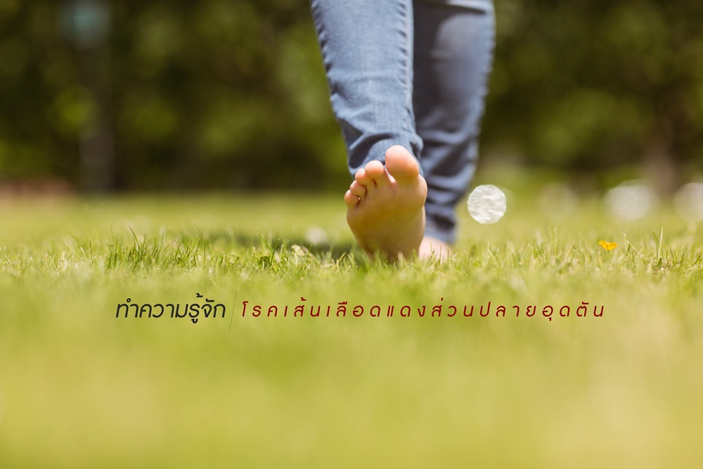 ทำความรู้จัก โรคเส้นเลือดแดงส่วนปลายอุดตัน thaihealth