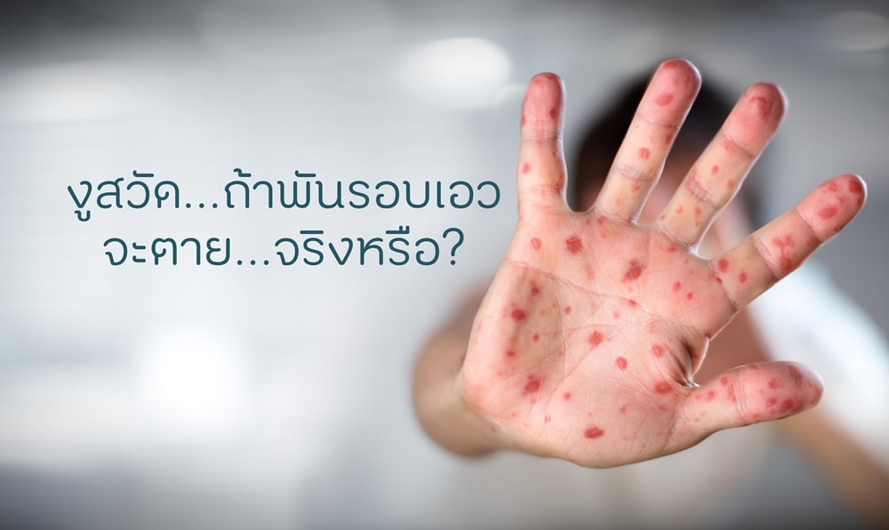 งูสวัด...ถ้าพันรอบเอวจะตาย...จริงหรือ? thaihealth