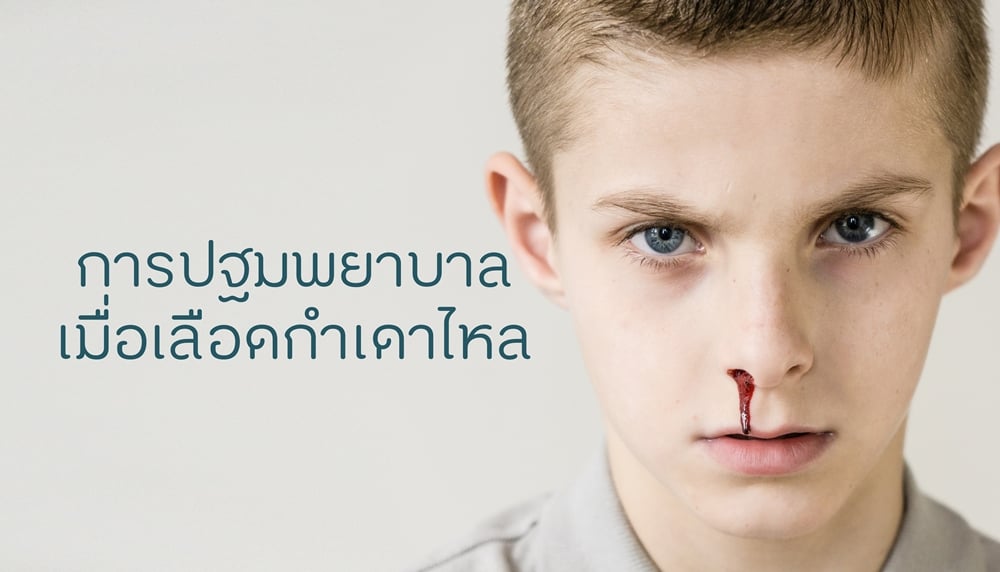 การปฐมพยาบาลเมื่อเลือดกำเดาไหล thaihealth
