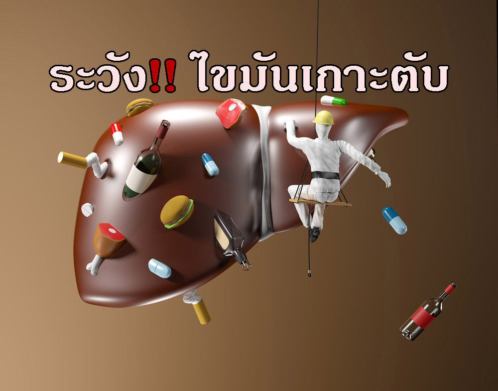 ระวัง!! ไขมันเกาะตับ thaihealth