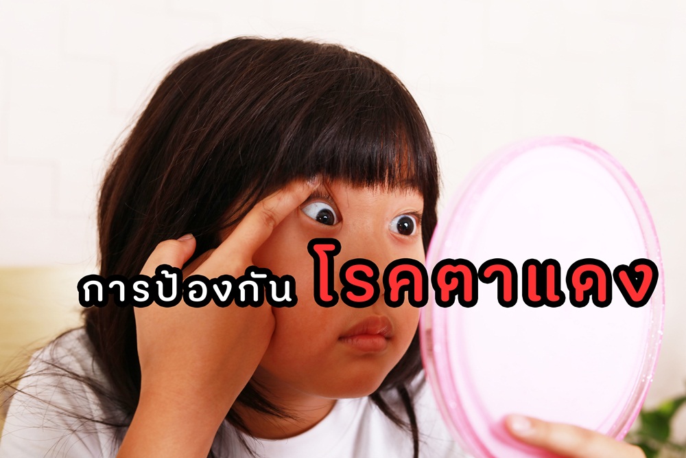 การป้องกันโรคตาแดง thaihealth