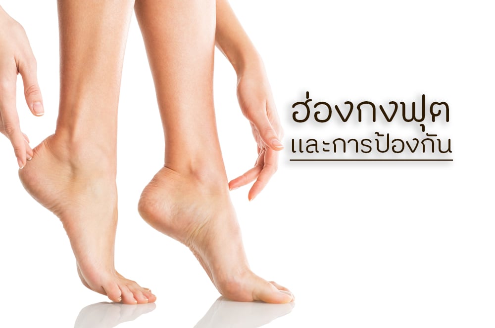 ฮ่องกงฟุต และวิธีป้องกัน thaihealth
