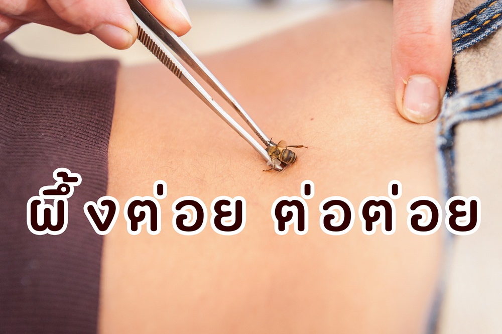 ผึ้งต่อย ต่อต่อย thaihealth