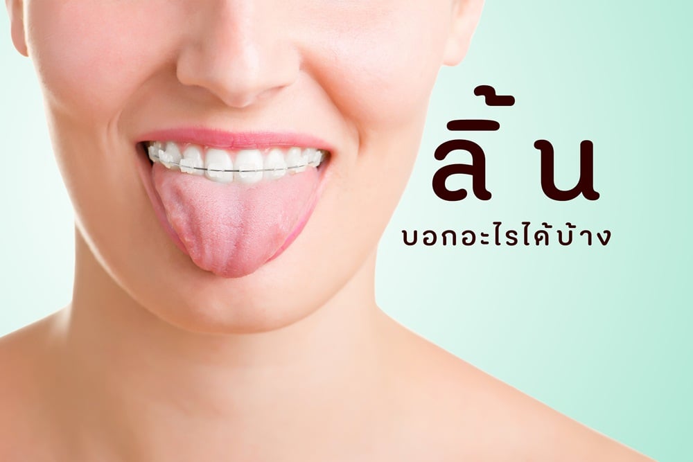 ลิ้นบอกอะไรได้บ้าง  thaihealth