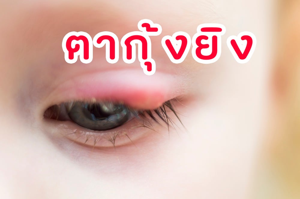ตากุ้งยิง thaihealth