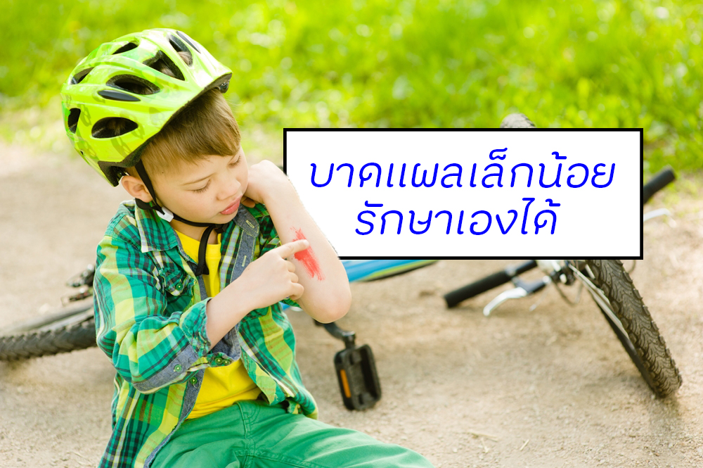 บาดแผลเล็กน้อย รักษาเองได้  thaihealth