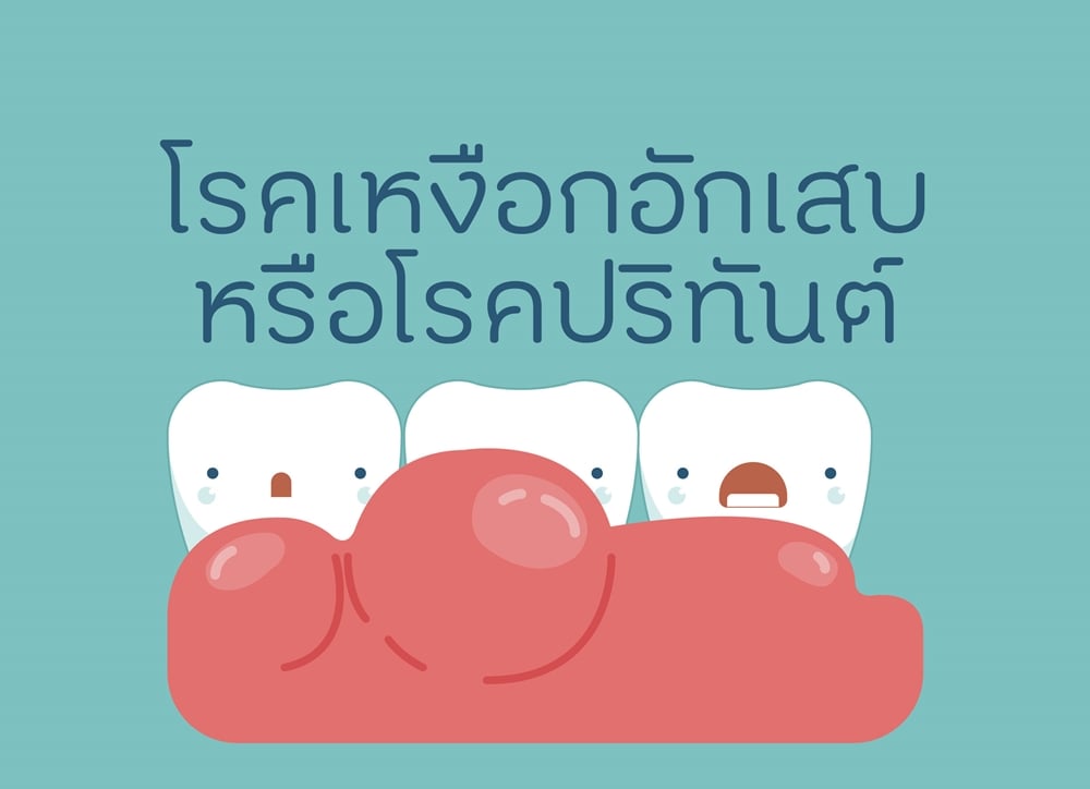 โรคเหงือกอักเสบ หรือโรคปริทันต์  thaihealth