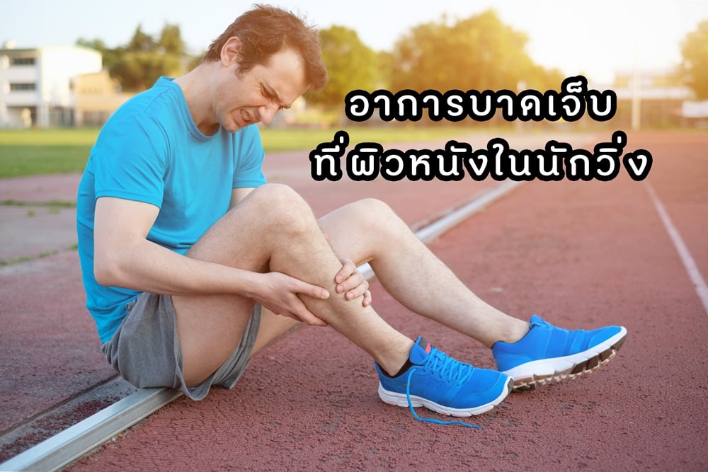 อาการบาดเจ็บที่ผิวหนังในนักวิ่ง thaihealth