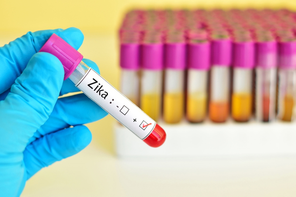 กรุงเทพฯ พบป่วยไวรัสซิกา 124 ราย เขตบางนามากสุด thaihealth