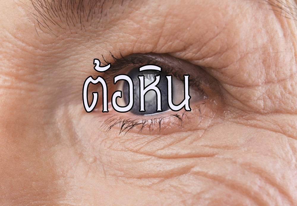 ต้อหิน thaihealth