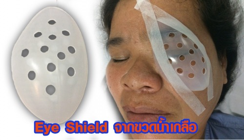 ฝาครอบตา (Eye Shield) จากขวดน้ำเกลือ thaihealth