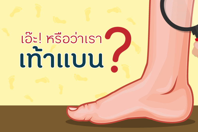 เอ๊ะ!! หรือว่าเราเท้าแบน	 thaihealth