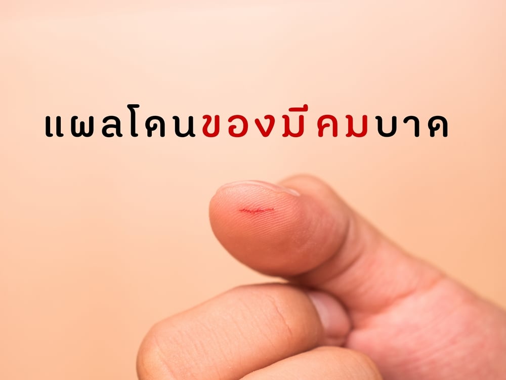 แผลโดนของมีคมบาด thaihealth