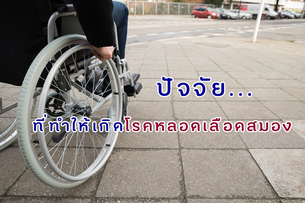 ปัจจัยที่ทำให้เกิดโรคหลอดเลือดสมอง thaihealth