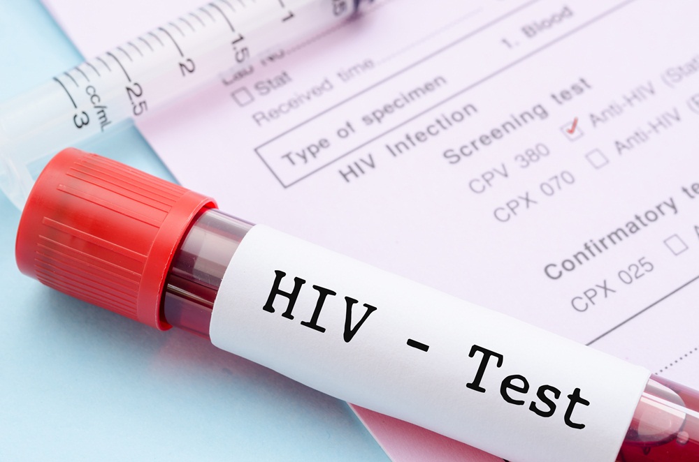 แนะกลุ่มเสี่ยงตรวจเอชไอวีปีละ2ครั้ง thaihealth