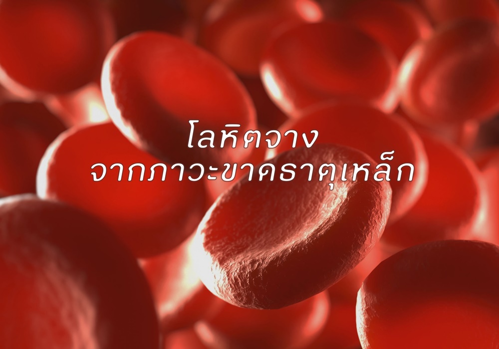 โลหิตจาง จากภาวะขาดธาตุเหล็ก thaihealth