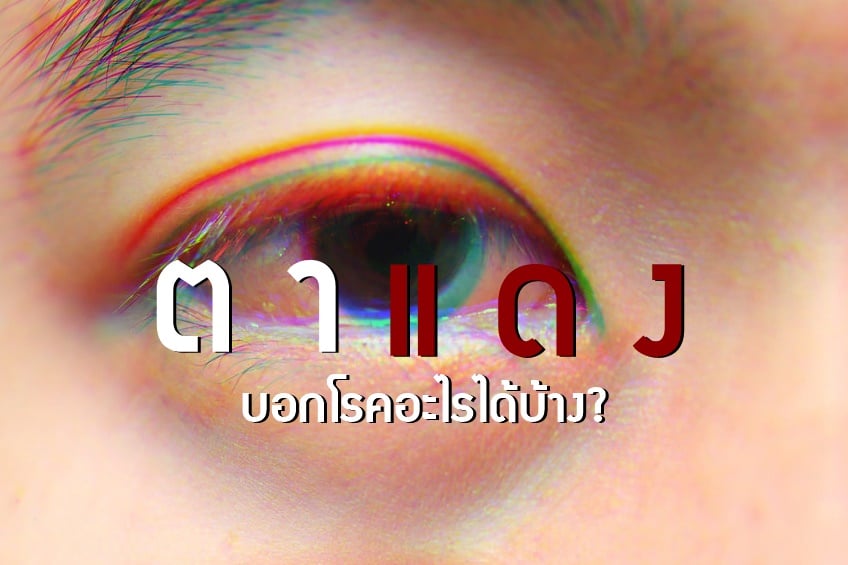 `ตาแดง` บอกโรคอะไรได้บ้าง? thaihealth