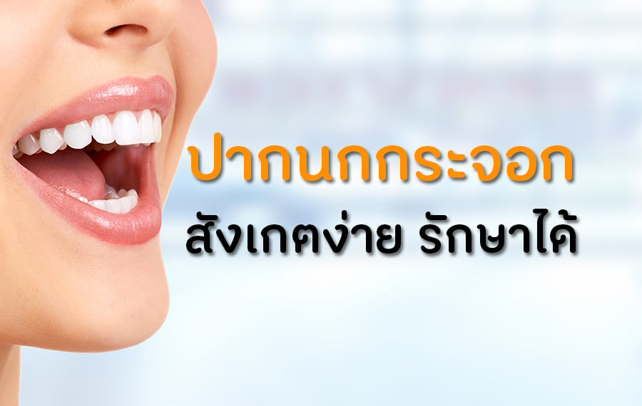 ปากนกกระจอกสังเกตง่ายรักษาได้ thaihealth