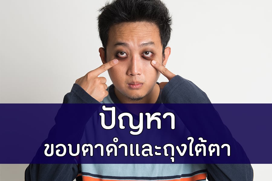 ปัญหาขอบตาดำและถุงใต้ตา thaihealth