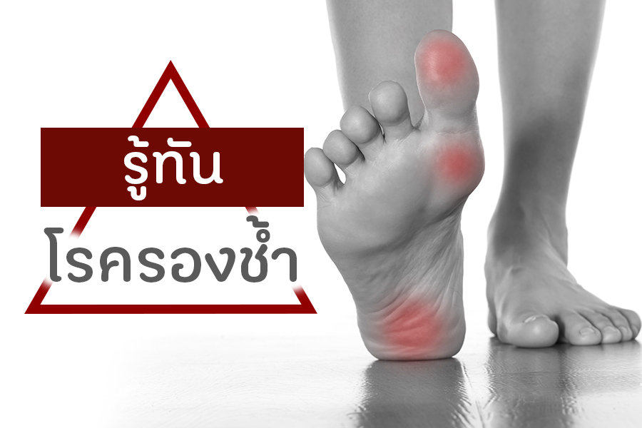 รู้ทันโรครองช้ำ  thaihealth