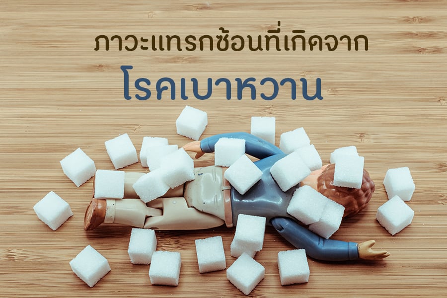 ภาวะแทรกซ้อนที่เกิดจากโรคเบาหวาน thaihealth