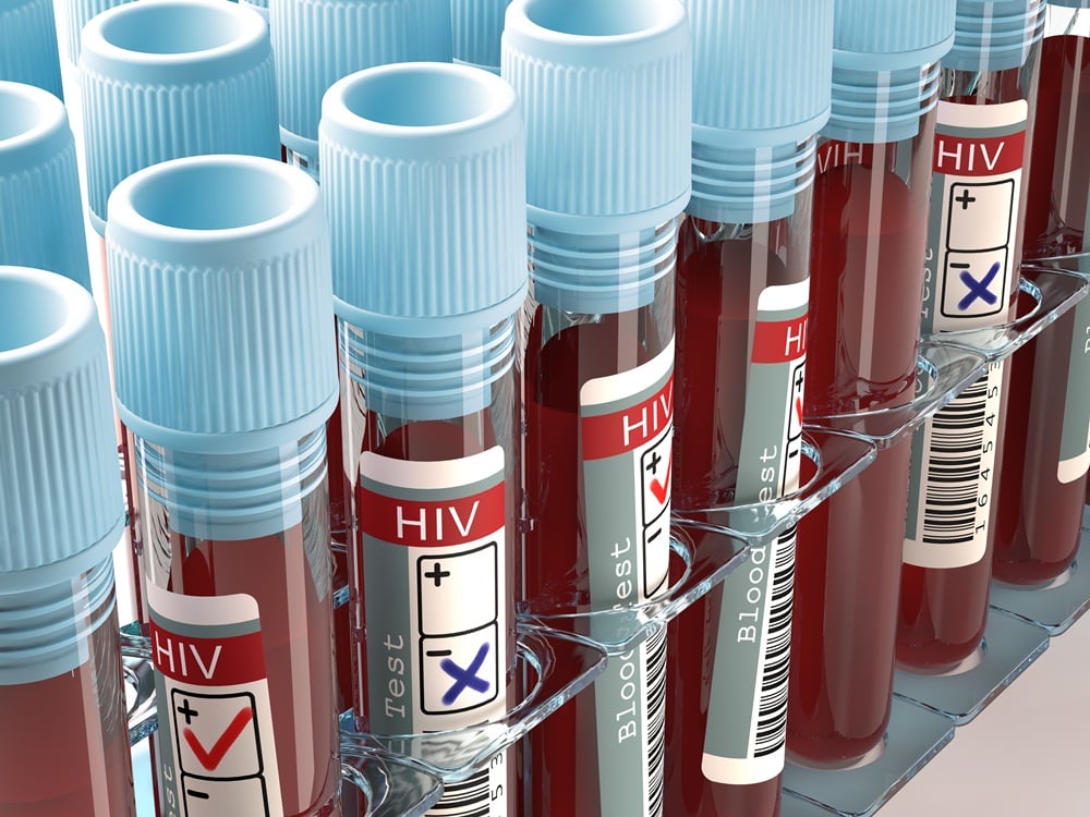 การติดเชื้อเอชไอวีกว่าครึ่ง ผู้ติดเชื้อใหม่เป็นวัยรุ่น thaihealth