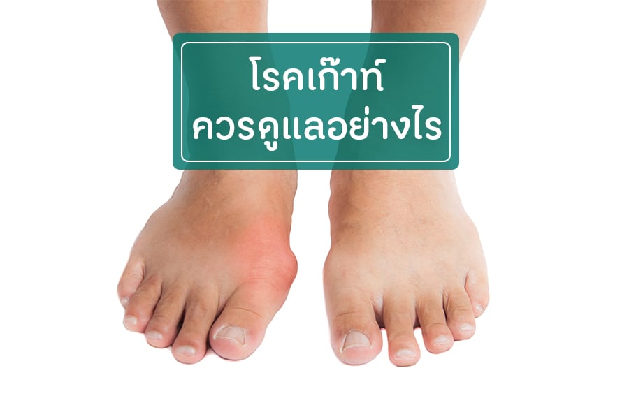 โรคเก๊าท์ ควรดูแลอย่างไร thaihealth