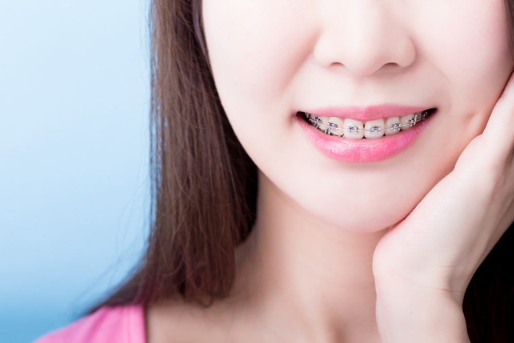 จัดฟันแฟชั่นในคลินิกเถื่อน เสี่ยงติดเชื้อ อันตรายถึงชีวิต thaihealth